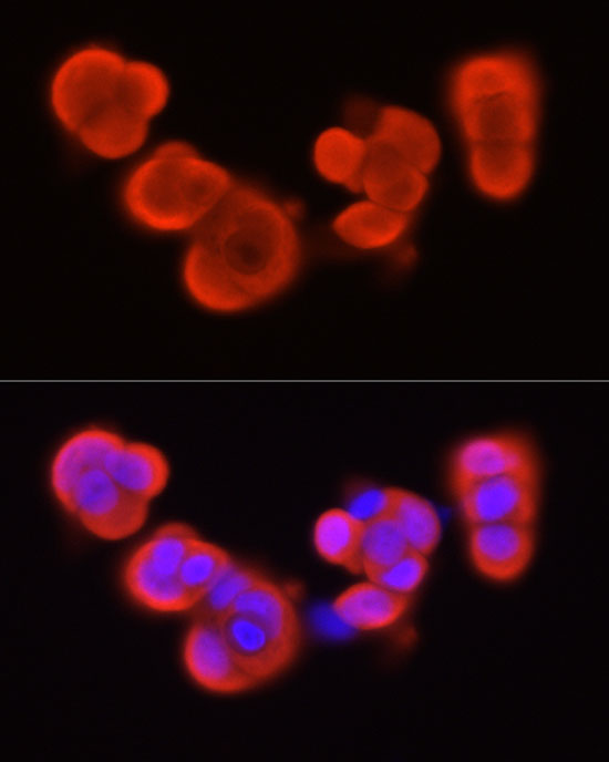 S100A11 Rabbit polyclonal antibody