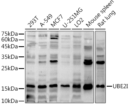 UBE2I Rabbit polyclonal antibody