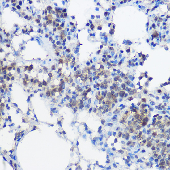 UBE2I Rabbit polyclonal antibody