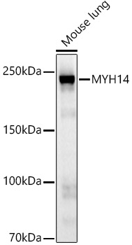 MYH14 Rabbit monoclonal antibody