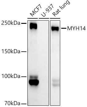 MYH14 Rabbit monoclonal antibody