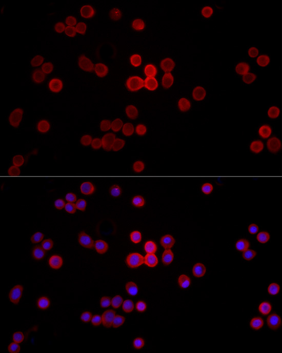 MYH14 Rabbit monoclonal antibody
