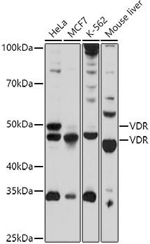 VDR Rabbit polyclonal antibody