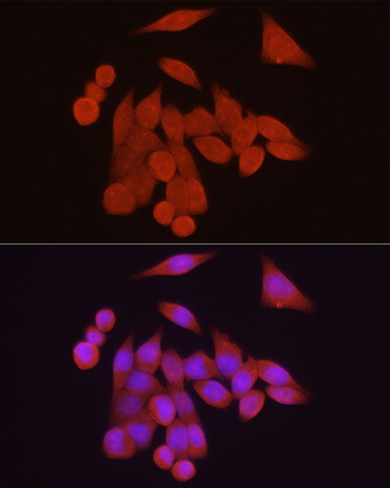 VDR Rabbit polyclonal antibody