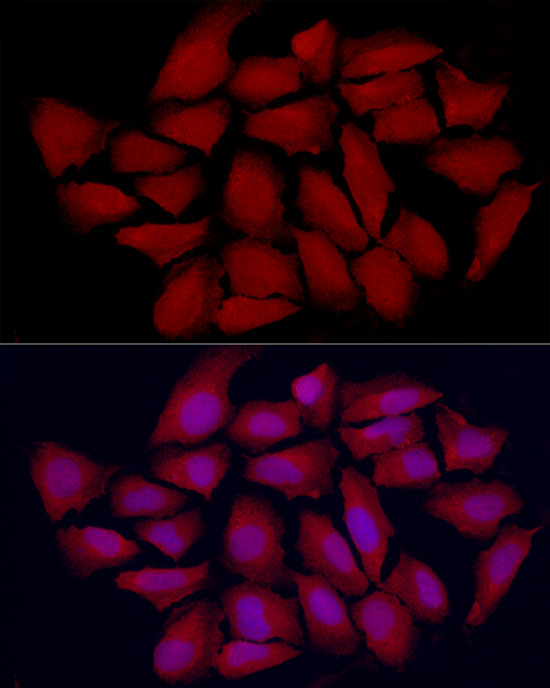 VDR Rabbit polyclonal antibody