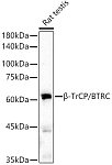 Western blot - β-TrCP/BTRC Rabbit mAb (A21951)