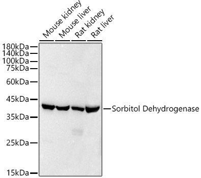 Sorbitol Dehydrogenase Rabbit monoclonal antibody