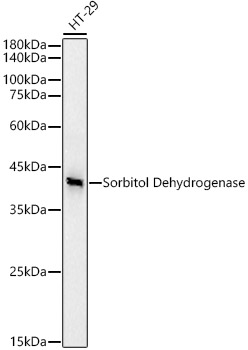 Sorbitol Dehydrogenase Rabbit monoclonal antibody