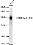 Western blot - CEBP Delta/CEBPD Rabbit mAb (A21954)