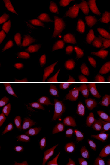 DLGAP5 Rabbit polyclonal antibody