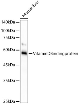 Vitamin D Binding protein Rabbit monoclonal antibody