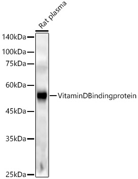 Vitamin D Binding protein Rabbit monoclonal antibody