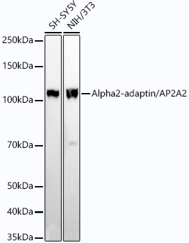 Alpha2-adaptin/AP2A2 Rabbit mAb