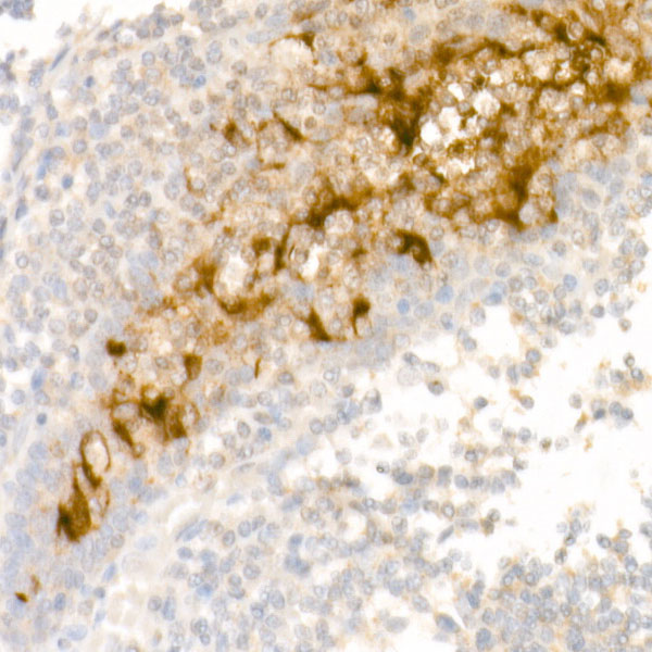 Mesothelin Rabbit monoclonal antibody