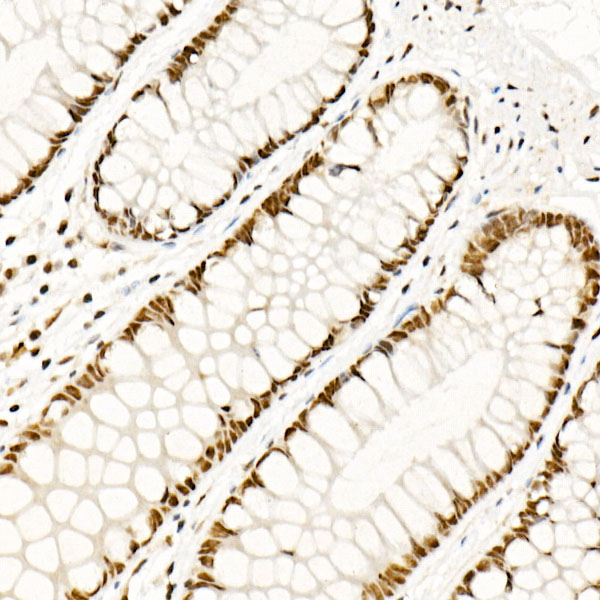 HSF1 Rabbit polyclonal antibody