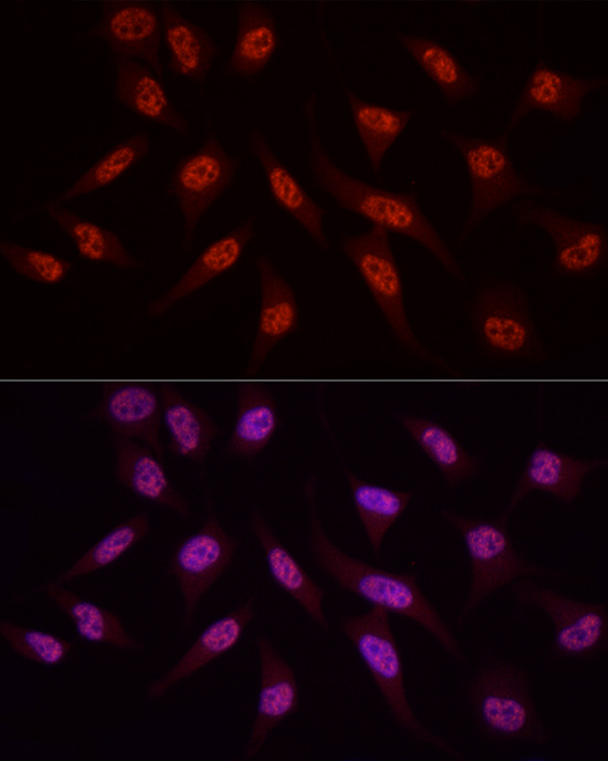 WTAP Rabbit polyclonal antibody