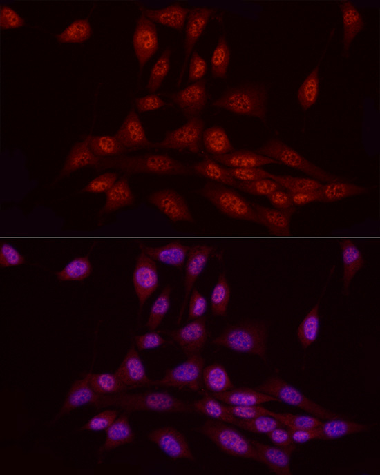 WTAP Rabbit polyclonal antibody
