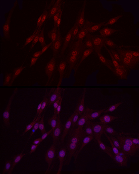WTAP Rabbit polyclonal antibody