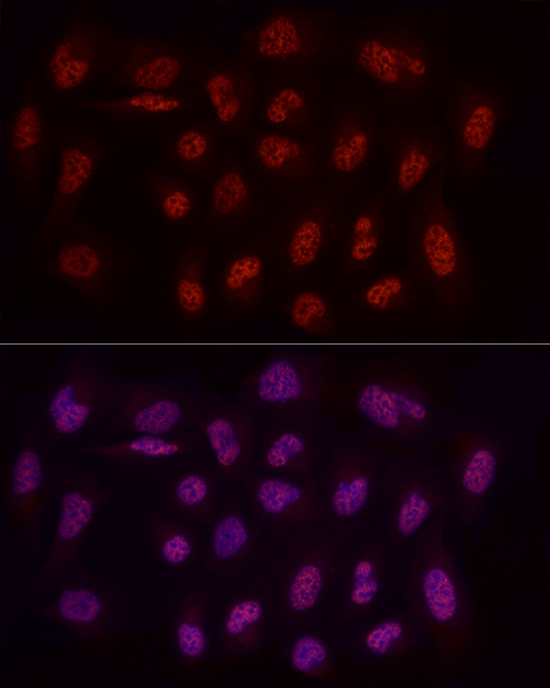 WTAP Rabbit polyclonal antibody
