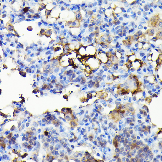 NADPH oxidase 4 (NOX4) Rabbit polyclonal antibody