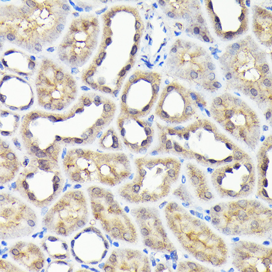 NADPH oxidase 4 (NOX4) Rabbit polyclonal antibody