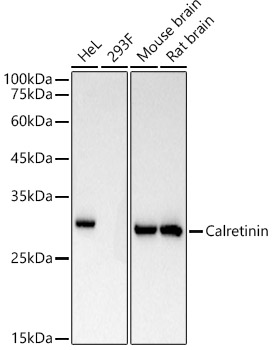 Calretinin Rabbit monoclonal antibody