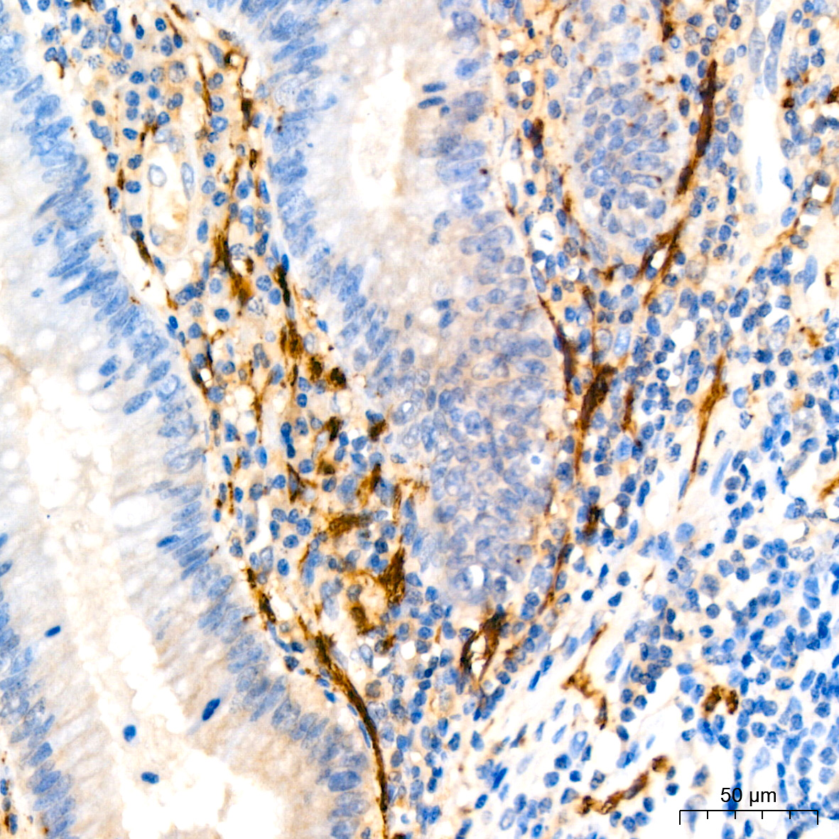 Calretinin Rabbit monoclonal antibody