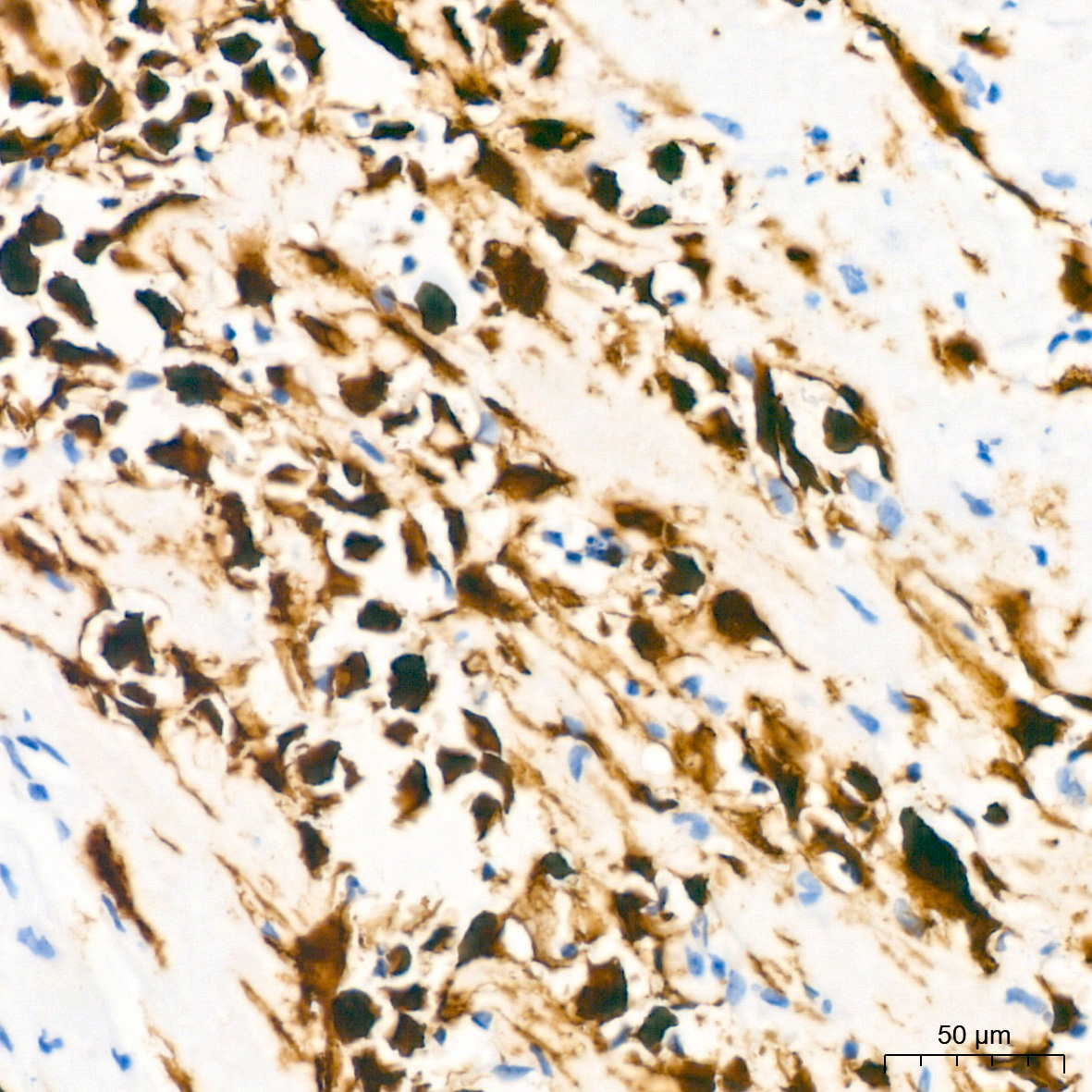 Calretinin Rabbit monoclonal antibody