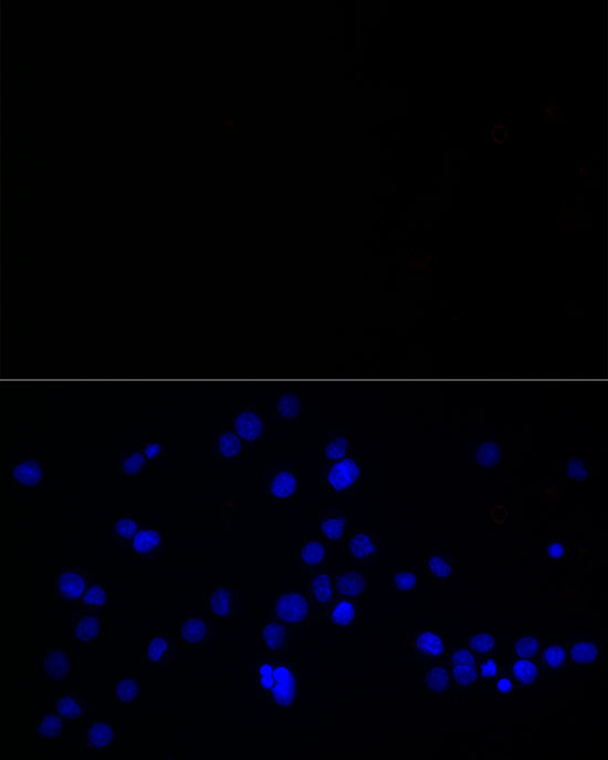 Calretinin Rabbit monoclonal antibody