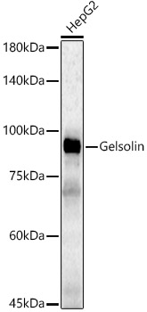 [KD Validated] Gelsolin Rabbit polyclonal antibody