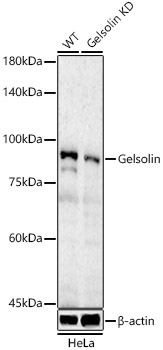 [KD Validated] Gelsolin Rabbit polyclonal antibody