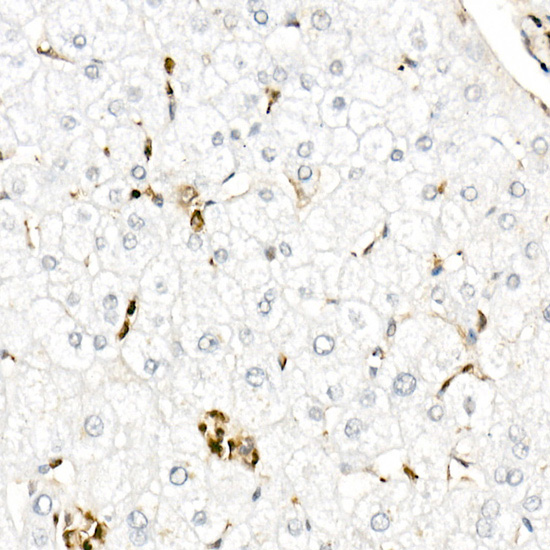 [KD Validated] Gelsolin Rabbit polyclonal antibody