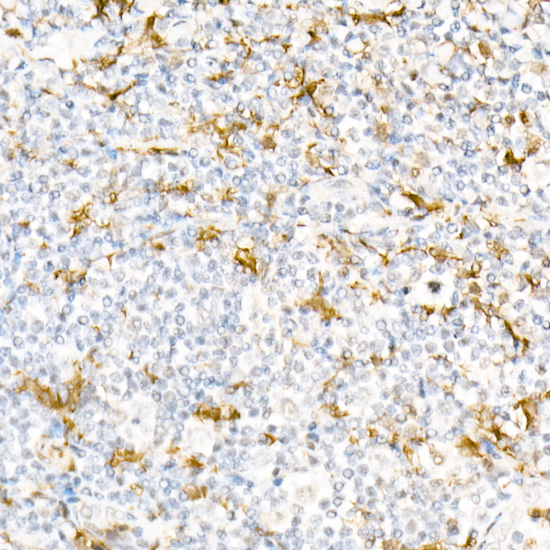 [KD Validated] Gelsolin Rabbit polyclonal antibody