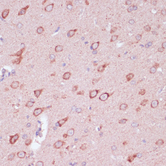 TOLLIP Rabbit polyclonal antibody
