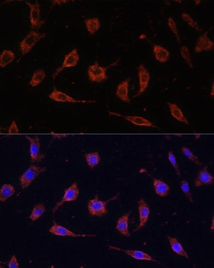 TOLLIP Rabbit polyclonal antibody