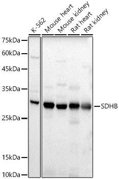 SDHB Rabbit polyclonal antibody