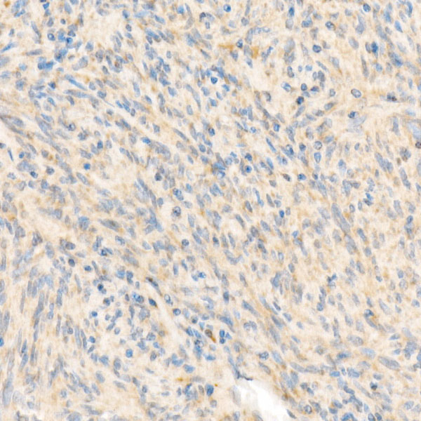 SDHB Rabbit polyclonal antibody