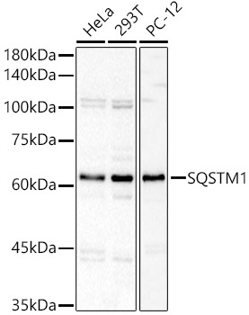 SQSTM1 Rabbit polyclonal antibody