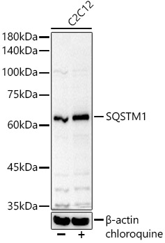 SQSTM1 Rabbit polyclonal antibody