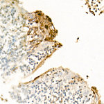 Western blot - S100A7/Psoriasin Rabbit pAb (A22026)