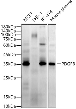 PDGFB Rabbit monoclonal antibody
