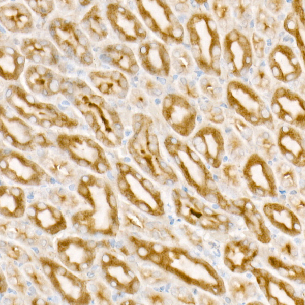 PDGFB Rabbit monoclonal antibody