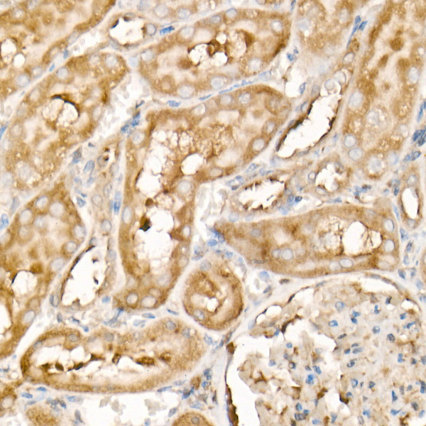 PDGFB Rabbit monoclonal antibody