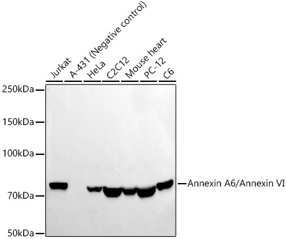 Annexin A6/Annexin VI Rabbit monoclonal antibody
