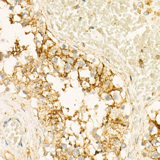 Annexin A6/Annexin VI Rabbit monoclonal antibody
