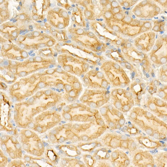 Annexin A6/Annexin VI Rabbit monoclonal antibody