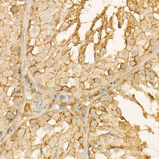 Annexin A6/Annexin VI Rabbit monoclonal antibody