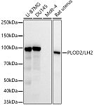 Western blot - PLOD2/LH2 Rabbit mAb (A22040)