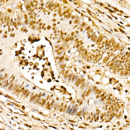 PBEF/Visfatin/NAMPT Rabbit monoclonal antibody