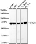 Western blot - GLP2R Rabbit mAb (A22049)
